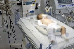 Tạm giữ nghi phạm bạo hành bé gái hơn 2 tháng tuổi chấn thương sọ não ở Đà Lạt