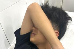 Nam sinh ở Đà Nẵng bị nhóm thanh niên đánh gãy 4 răng, nhấn xuống biển