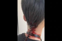 Mâu thuẫn cá nhân, sinh viên đại học ở Thủ đô đánh bạn chảy máu tại trường học