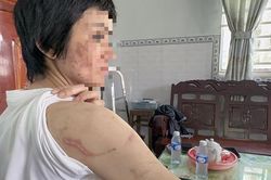 Người chồng bị tố bạo hành dã man vợ mang bầu 7 tháng khai gì?