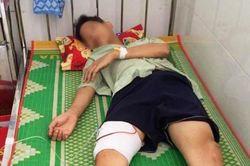 Điều tra vụ hỗn chiến trong đêm tại Quy Nhơn