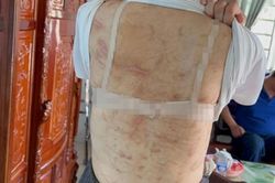 Vụ vợ mang thai 7 tháng bị chồng bạo hành như thời trung cổ: Bất ngờ trước lời khai của người chồng