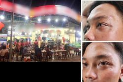 Khánh Hòa: Chỉ đạo điều tra, xử lý nhân viên quán hải sản hành hung du khách
