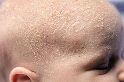 Những điều cần phải biết khi chọn dầu gội đầu cho trẻ nhỏ