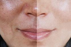 7 loại thực phẩm giúp chậm lão hóa da, ngừa cháy nắng