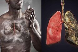 Tại sao không hút thuốc vẫn bị ung thư phổi?