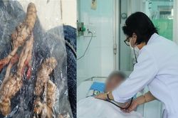 Ăn xác nhộng ve sầu vì nhầm tưởng thuốc quý, người đàn ông suýt tử vong