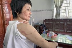 Công an tìm thấy 205 vết thương trên thân thể người vợ mang bầu 7 tháng