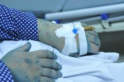32 tuổi tử vong do mắc thủy đậu: Bác sĩ khuyến cáo điều thường bỏ qua