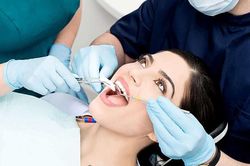 Chi phí nhổ răng của người dân có được bảo hiểm y tế chi trả không?