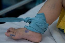 TPHCM: Một trường hợp tử vong do nghi mắc tay chân miệng