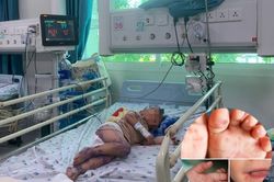 TP.HCM: Virus gây bệnh tay chân miệng nặng ở trẻ em tái xuất