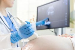 4 mốc siêu âm quan trọng thai phụ cần nhớ