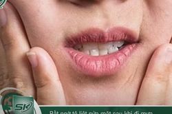 Bất ngờ tê liệt nửa mặt sau khi đi mưa