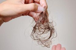 Những lý do tiềm ẩn khiến bạn bị rụng tóc