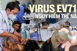 Virus gây bệnh tay chân miệng đã trở lại: EV71 nguy hiểm thế nào?