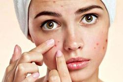 Những trái cây mùa hè không nên ăn quá nhiều dù ngon đấy mấy kẻo nóng gan, nổi mụn