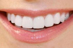 Chảy máu chân răng dấu hiệu của bệnh gì?