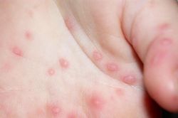 An Giang triển khai đồng bộ biện pháp phòng, chống dịch bệnh tay- chân- miệng