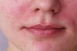 Các vấn đề về da và tóc phổ biến mà phụ nữ phải đối mặt