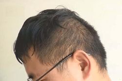 Bị lừa trả 1.400 USD khi đi cắt tóc ở Trung Quốc