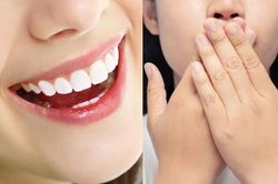 Giải pháp ngăn chặn hôi miệng do bọc răng sứ
