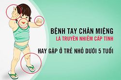 Các biện pháp phòng bệnh tay - chân - miệng