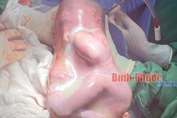 Thú vị bé gái chào đời trong 'bọc điều' hiếm gặp