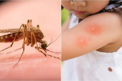 Mẹo hay giúp giảm ngứa khi bị muỗi đốt