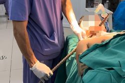 Người đàn ông bị xà beng đâm xuyên cổ