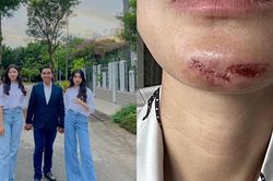 Sao Việt 19/6: Mạnh Trường, Quyền Linh khoe con gái, Minh Tú bị rách cằm khi đi làm