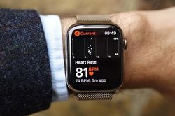 Apple Watch lập công giúp cứu người phụ nữ khỏi cục máu đông nguy hiểm