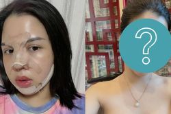 Cô gái 29 tuổi 'lột xác' sau khi chi 500 triệu chỉnh sửa nhan sắc: Đẹp có động lực làm việc hơn