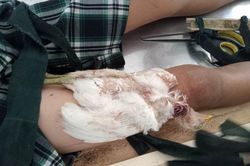Quảng Ngãi: Một thanh niên phải cấp cứu vì chữa bệnh mê tín dị đoan