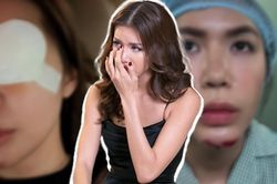 Minh Tú tiếp tục gây lo lắng hậu bị tai nạn phải khâu hơn 10 mũi: Hết cằm lại tới mắt!