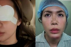 Minh Tú tiếp tục gặp vấn đề sức khỏe sau sự cố phải khâu 10 mũi ở cằm