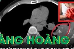 Bàng hoàng nhận tin ung thư phổi sau 10 ngày đau ngực, sút cân