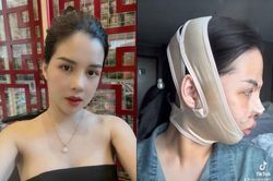 Chi nửa tỷ chỉnh sửa nhan sắc, gái xinh Quảng Ninh 'lột xác' thành công