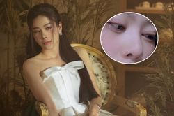 Nam Em gây lo lắng với gương mặt hốc hác, mắt sưng vù: Chuyện gì đang xảy ra?