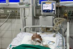 Nam thanh niên cứng hàm, khó nói sau 15 ngày bị gạch rơi vào ngón chân