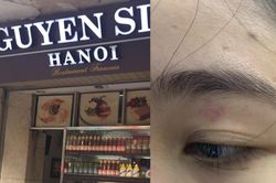Chủ quán bánh mì Nguyên Sinh bị tố đánh khách: 'Nhân viên chỉ phẩy tay nhẹ'