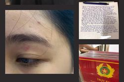 Vụ nhân viên quán bánh mì lao vào đấm khách: Chuyển hồ sơ lên Công an quận