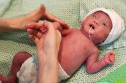 Hành trình kỳ diệu của em bé chào đời nặng 400g, lọt thỏm trong bàn tay bác sĩ