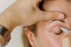 Người phụ nữ bị sót chỉ khâu trên mặt sau khi làm đẹp hết 60 triệu đồng