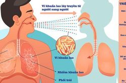 Yếu tố nguy cơ và cách phòng ngừa lao phổi