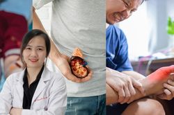 Người đàn ông suy thận giai đoạn cuối bật khóc khi biết nguyên nhân từ 1 thói quen
