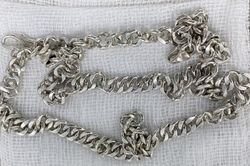 Bé gái 6 tuổi nuốt sợi dây chuyền 'khủng' vào bụng