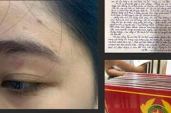 Xử phạt 2 nhân viên quán bánh mì Nguyên Sinh đánh khách