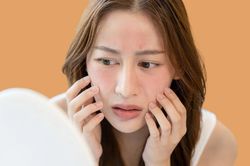 10 cách nhận biết da nhạy cảm để tránh gặp 'sự cố'