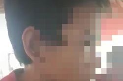 Điều tra vụ con riêng của vợ bị cha dượng đốt bộ phận sinh dục